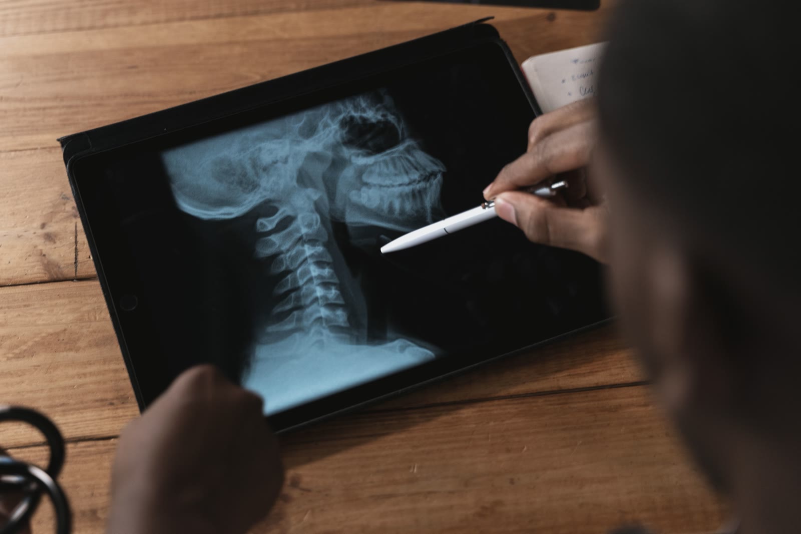 Analiza zdjęcia cefalometrycznego czaszki na tablecie